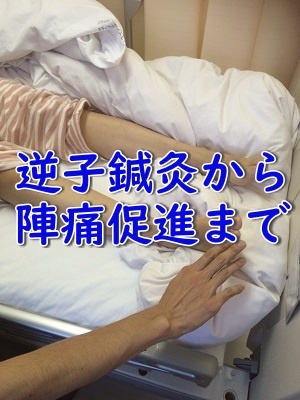 逆子鍼灸再び！戻るが臍帯下垂で帝王切開？そして陣痛促進の鍼灸。の画像