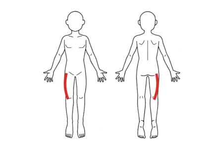 外側大腿皮神経